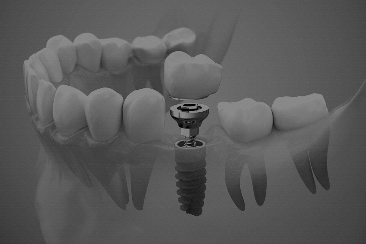 Blog,manejar el miedo,dentista en niños