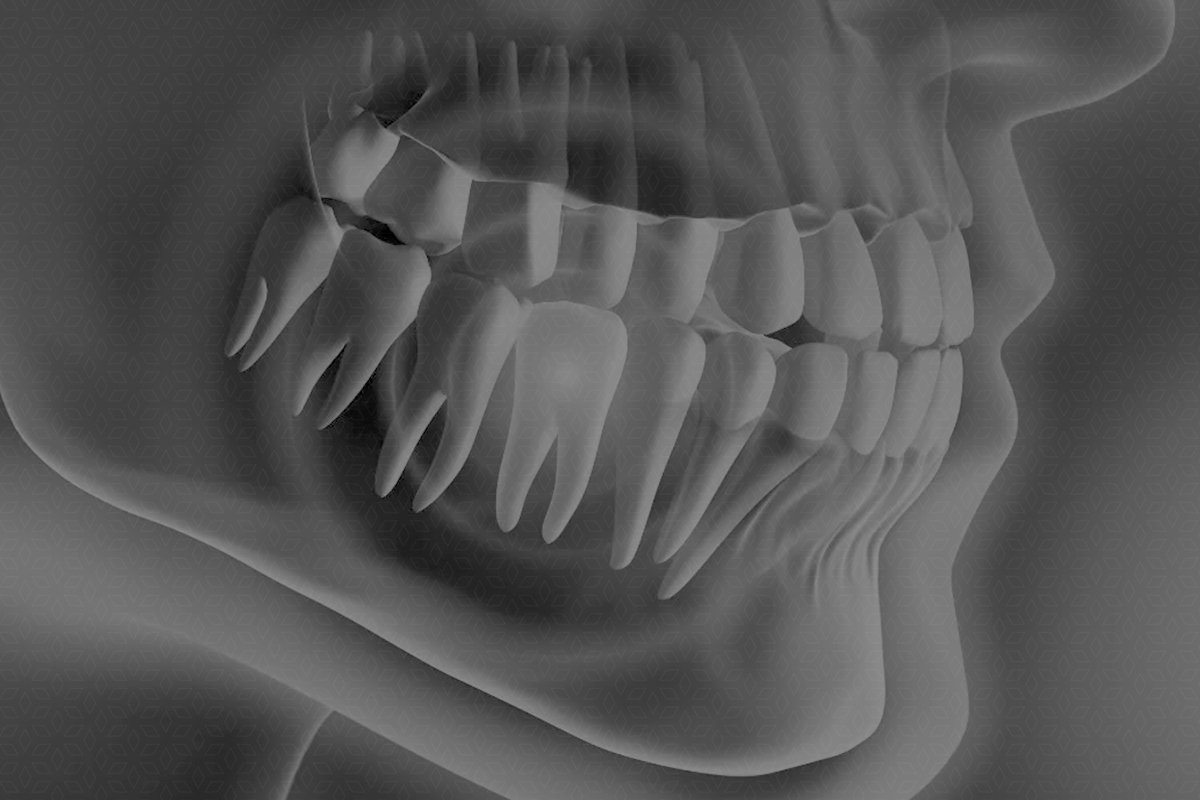 Blog,manejar el miedo,dentista en niños