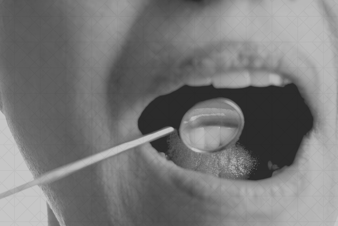 Estética dental,Elche,El Altet,Esther Sánchez,Dentales